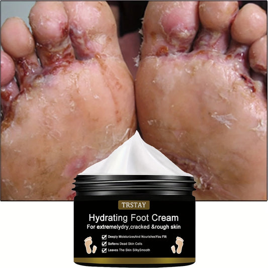 [Moisturizing Cream] TRSTAY Foot Moisturizing Cream | Treating Dry, Cracked, And Rough Skin | Providing Hydration for Dry, Cracked Feet And Heels